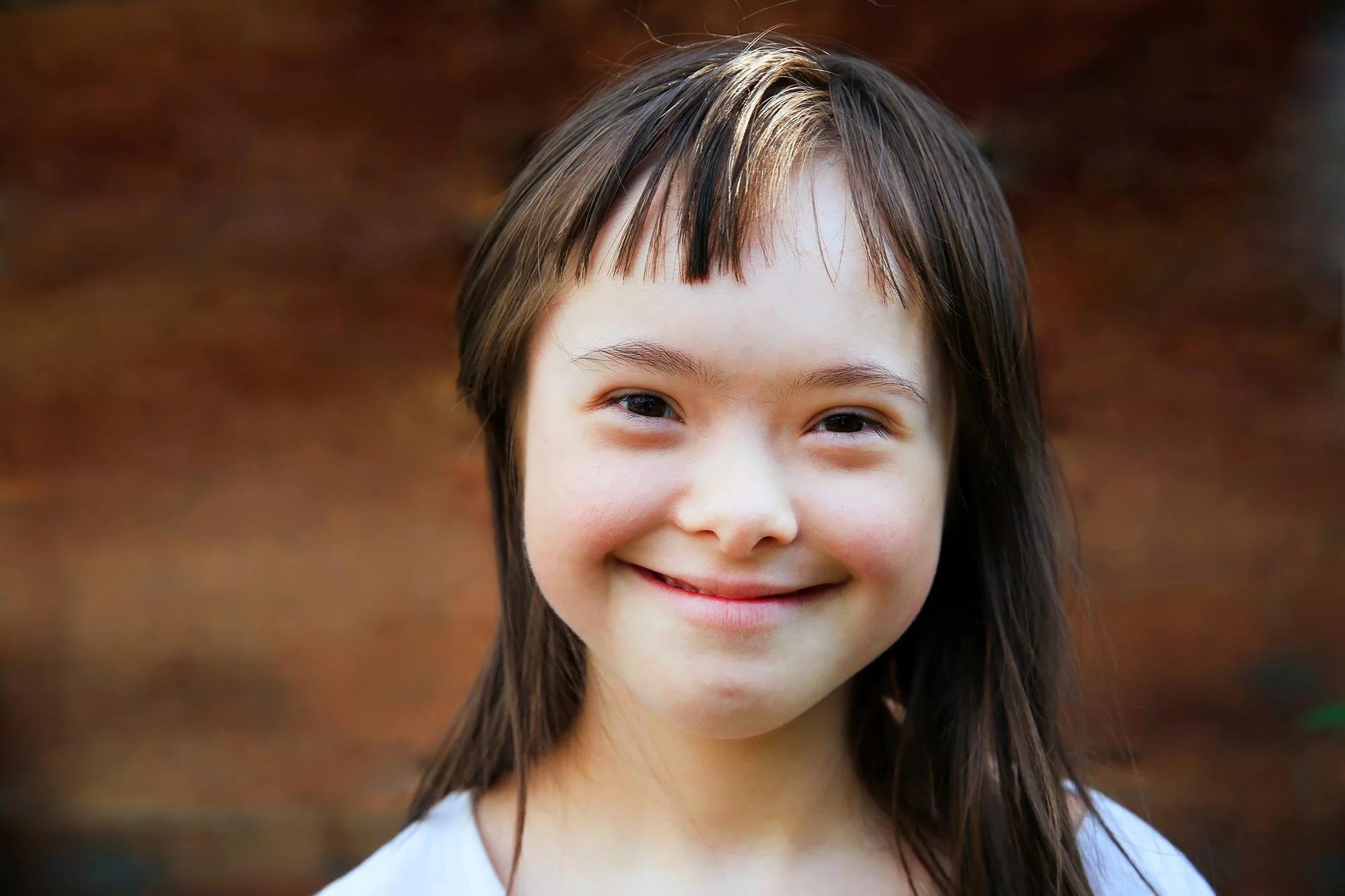 Smiling Girl Downs Syndrome