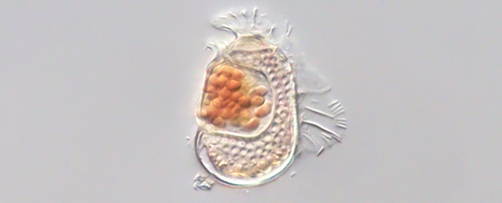 DianoflagellatHostOfMostVirusLikeOrganismMicroscope