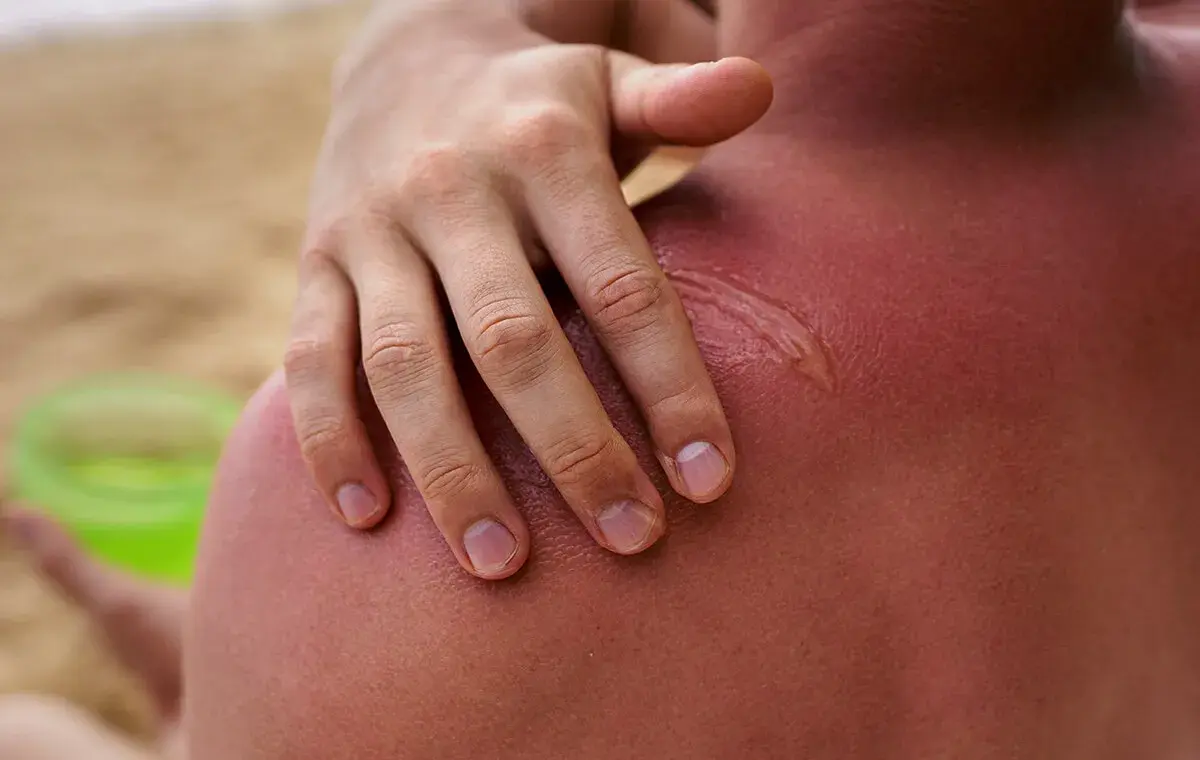 روش‌های روشن کردن پوست صورت در خانه